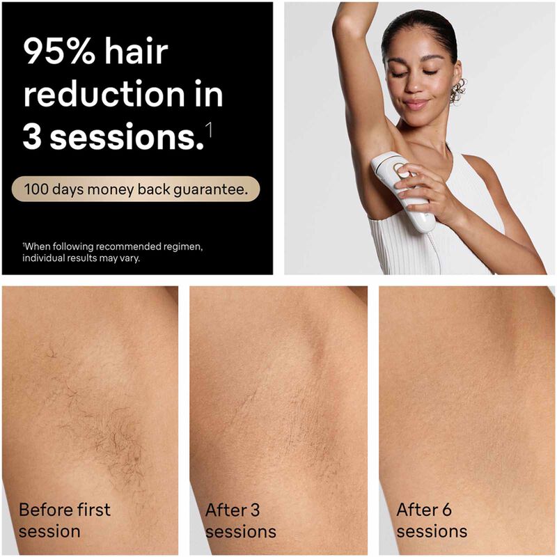 BRAUN Silk Expert Pro 5 Ipl Permanent Hair Removal PL 5221-image 3